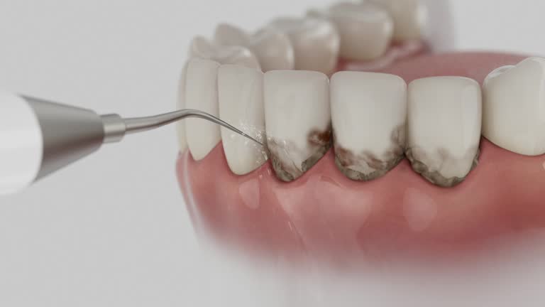 Trusted Teeth Cleaning And Checkup service in Rockville, MD - Dentist Open Now